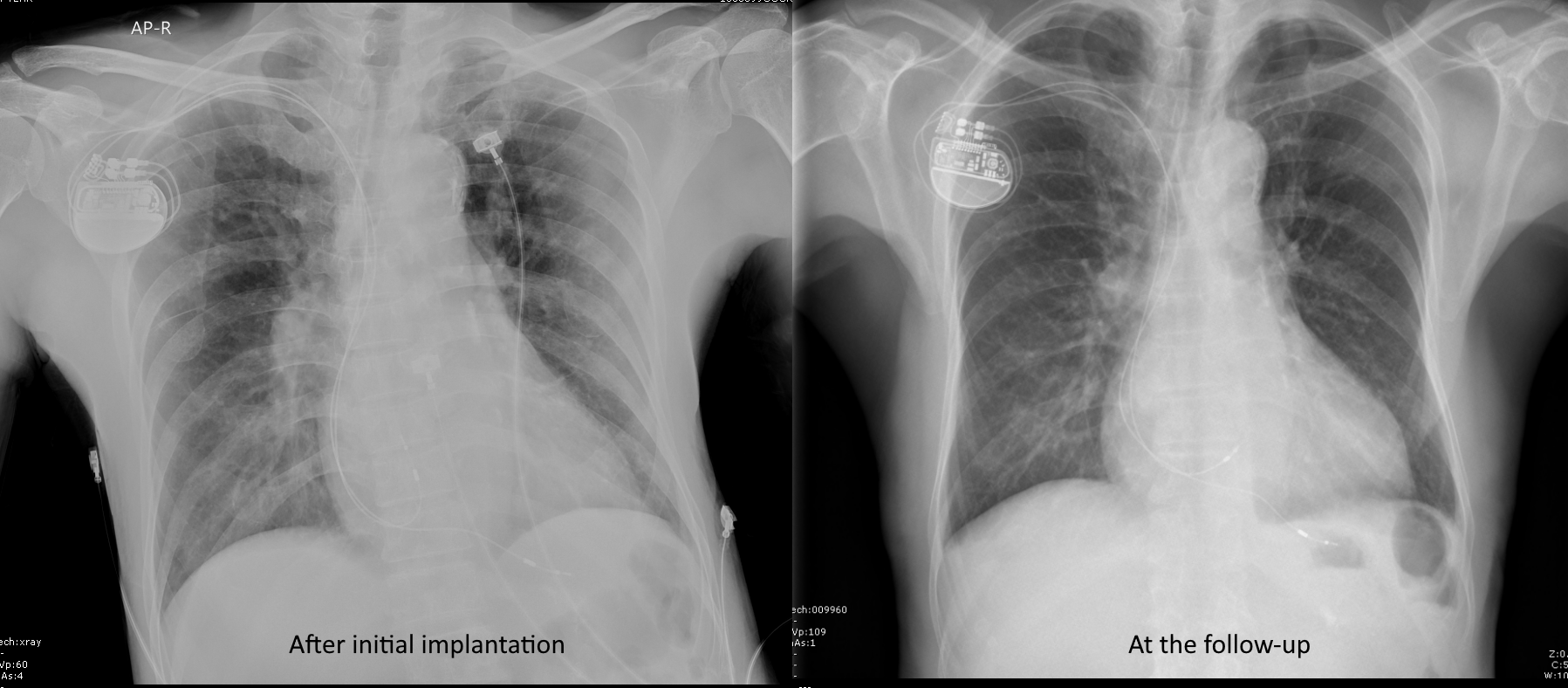 Cardiac Rhythm Device Troubleshooting