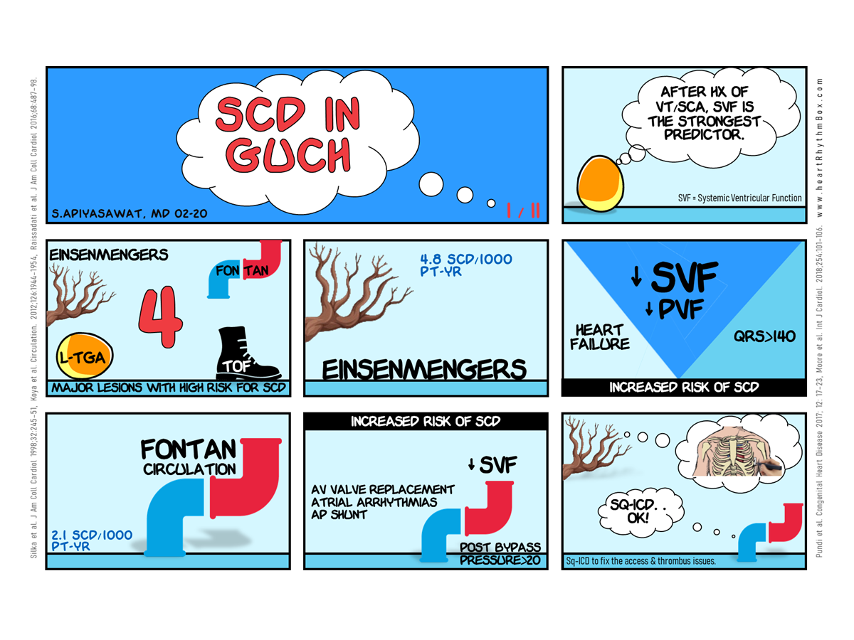 Heart Rhythm Box - Clinical Cardiac Elctrophysiology Tutorials